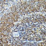 PIK3CG Antibody in Immunohistochemistry (Paraffin) (IHC (P))