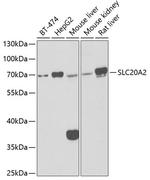 SLC20A2 Antibody in Western Blot (WB)