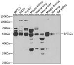 SPTLC1 Antibody in Western Blot (WB)