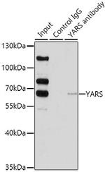 YARS Antibody in Immunoprecipitation (IP)