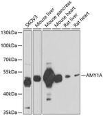 alpha Amylase 1 Antibody in Western Blot (WB)