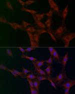 GOT2 Antibody in Immunocytochemistry (ICC/IF)