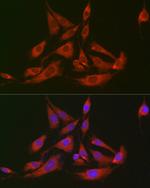 GOT2 Antibody in Immunocytochemistry (ICC/IF)