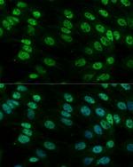 hnRNP M Antibody in Immunocytochemistry (ICC/IF)