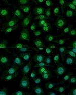 hnRNP M Antibody in Immunocytochemistry (ICC/IF)