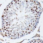 hnRNP M Antibody in Immunohistochemistry (Paraffin) (IHC (P))