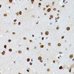 hnRNP M Antibody in Immunohistochemistry (Paraffin) (IHC (P))