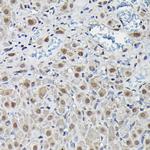 PFKFB3 Antibody in Immunohistochemistry (Paraffin) (IHC (P))