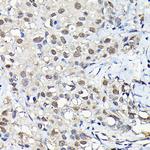 PFKFB3 Antibody in Immunohistochemistry (Paraffin) (IHC (P))