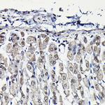 PFKFB3 Antibody in Immunohistochemistry (Paraffin) (IHC (P))