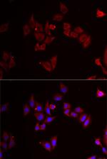 MEK5 Antibody in Immunocytochemistry (ICC/IF)