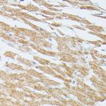 MEK5 Antibody in Immunohistochemistry (Paraffin) (IHC (P))