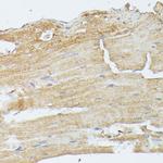 MEK5 Antibody in Immunohistochemistry (Paraffin) (IHC (P))