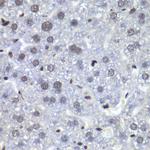 RBBP5 Antibody in Immunohistochemistry (Paraffin) (IHC (P))