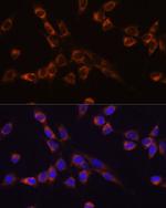 MST2 Antibody in Immunocytochemistry (ICC/IF)