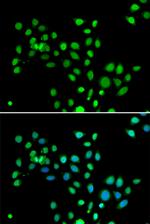 Histone Macro-H2A.1 Antibody in Immunocytochemistry (ICC/IF)