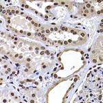 Histone Macro-H2A.1 Antibody in Immunohistochemistry (Paraffin) (IHC (P))