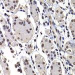 Histone Macro-H2A.1 Antibody in Immunohistochemistry (Paraffin) (IHC (P))