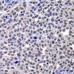 Histone Macro-H2A.1 Antibody in Immunohistochemistry (Paraffin) (IHC (P))