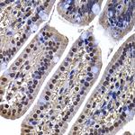 DNAJB6 Antibody in Immunohistochemistry (Paraffin) (IHC (P))