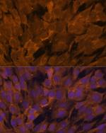 STAM2 Antibody in Immunocytochemistry (ICC/IF)