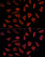 STAM2 Antibody in Immunocytochemistry (ICC/IF)