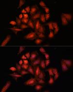 STAM2 Antibody in Immunocytochemistry (ICC/IF)