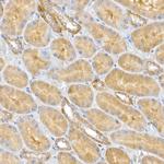 CLIC4 Antibody in Immunohistochemistry (Paraffin) (IHC (P))