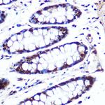 APIP Antibody in Immunohistochemistry (Paraffin) (IHC (P))