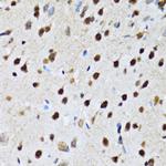 DBC1 Antibody in Immunohistochemistry (Paraffin) (IHC (P))