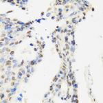 DBC1 Antibody in Immunohistochemistry (Paraffin) (IHC (P))