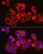 METTL7B Antibody in Immunocytochemistry (ICC/IF)