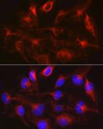 METTL7B Antibody in Immunocytochemistry (ICC/IF)