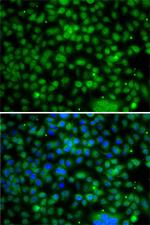 PHYHD1 Antibody in Immunocytochemistry (ICC/IF)