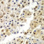 HnRNP Q Antibody in Immunohistochemistry (Paraffin) (IHC (P))