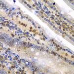 HnRNP Q Antibody in Immunohistochemistry (Paraffin) (IHC (P))