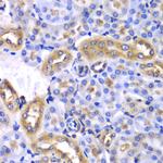 HnRNP Q Antibody in Immunohistochemistry (Paraffin) (IHC (P))