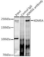 KDM5A Antibody in Immunoprecipitation (IP)