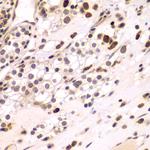 C/EBP gamma Antibody in Immunohistochemistry (Paraffin) (IHC (P))