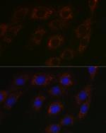 BCAT2 Antibody in Immunocytochemistry (ICC/IF)