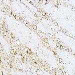 BCAT2 Antibody in Immunohistochemistry (Paraffin) (IHC (P))