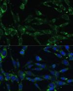 Calpain 5 Antibody in Immunocytochemistry (ICC/IF)