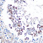 WISP2 Antibody in Immunohistochemistry (Paraffin) (IHC (P))