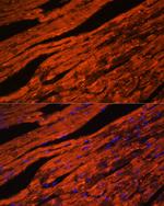 LDB3 Antibody in Immunocytochemistry (ICC/IF)