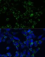 GluD1 Antibody in Immunocytochemistry (ICC/IF)