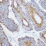 GluD1 Antibody in Immunohistochemistry (Paraffin) (IHC (P))