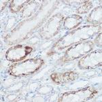 GluD1 Antibody in Immunohistochemistry (Paraffin) (IHC (P))