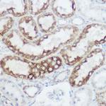 GluD1 Antibody in Immunohistochemistry (Paraffin) (IHC (P))