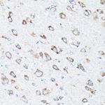 ETFA Antibody in Immunohistochemistry (Paraffin) (IHC (P))