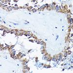 ETFA Antibody in Immunohistochemistry (Paraffin) (IHC (P))